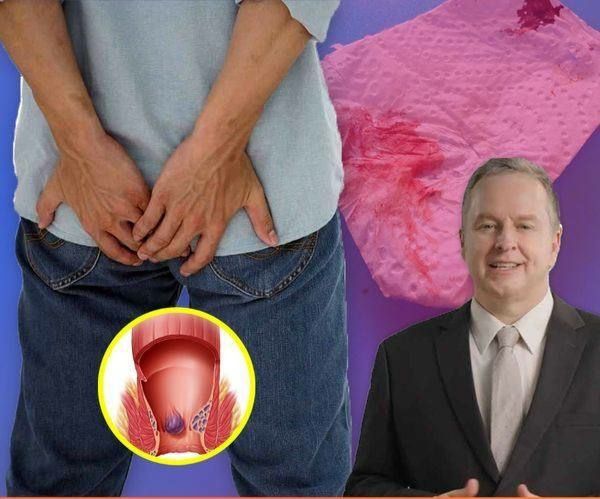 Примеры крео