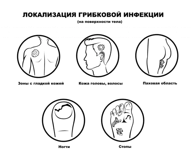Изображение приведено исключительно для упрощения запоминания зон локализации (читай — типов крео)