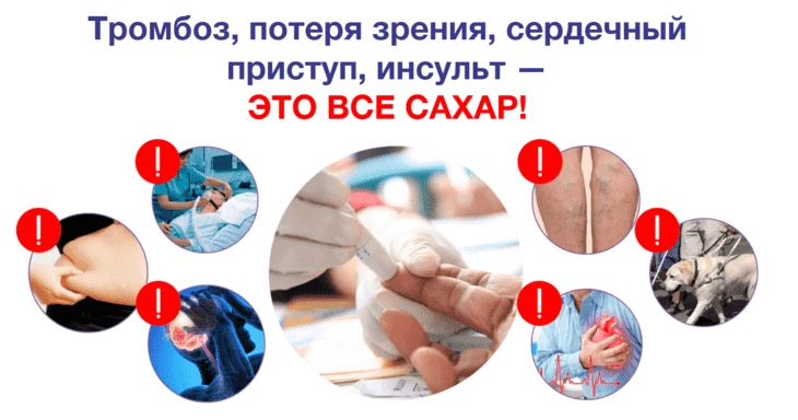 Пример акцента внимания на сахарах