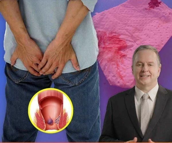 Примеры крео