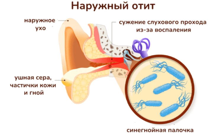 Вжух, и оказывается, что это не ты громко музыку слушаешь, а бариста не моет кофемашину