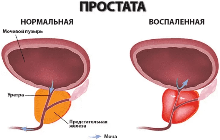 Где-то справа еще кишечник, дорисуйте в голове