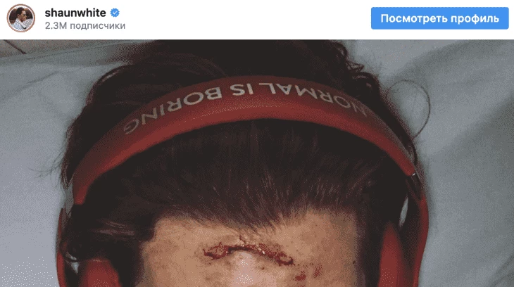 Пост Шона с повреждением лица 