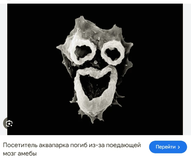 Повезло, что не от хламидиоза